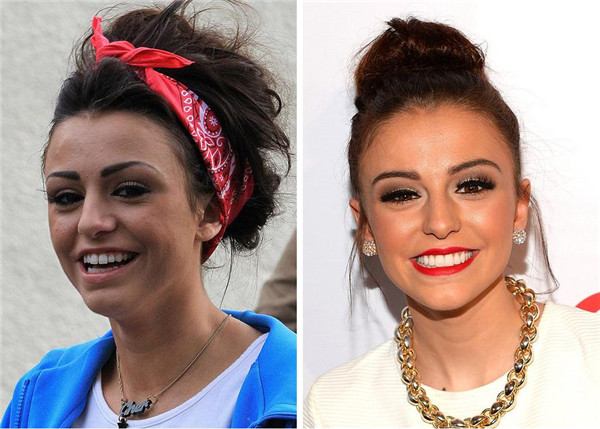 Cher Lloyd