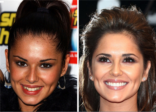 Cheryl Cole.