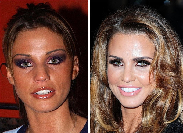 Katie Price