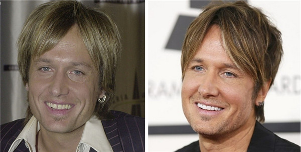 Keith Urban