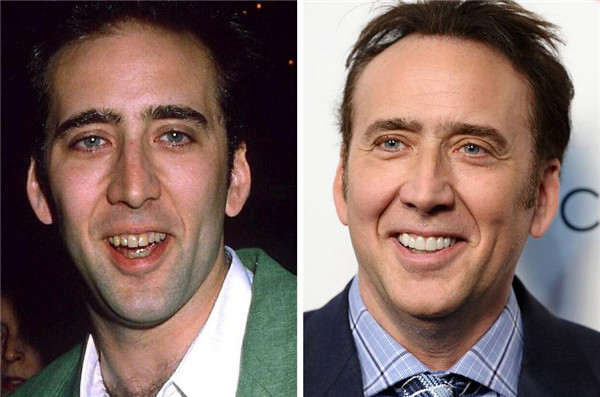 Nicolas Cage