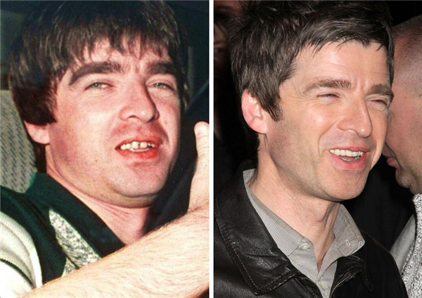 Noel Gallagher