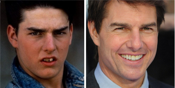 Tom Cruise